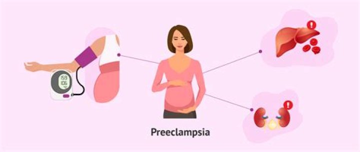 Can you die from eclampsia?
