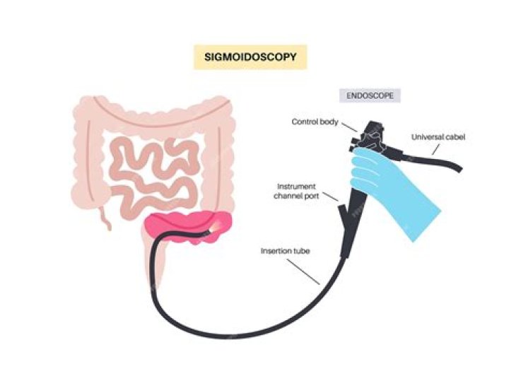 How painful is a sigmoidoscopy?