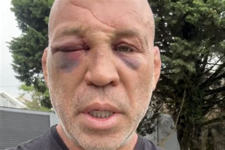 What happened Wanderlei Silva?